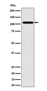 Anti-Nup107 Rabbit Monoclonal Antibody Boster Bio