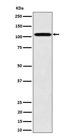 Anti-Nup107 Rabbit Monoclonal Antibody Boster Bio