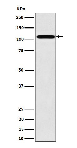 Anti-Nup107 Rabbit Monoclonal Antibody Boster Bio