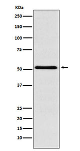 Anti-BAF57/SMARCE1 Rabbit Monoclonal Antibody Boster Bio
