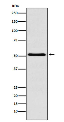 Anti-BAF57/SMARCE1 Rabbit Monoclonal Antibody Boster Bio