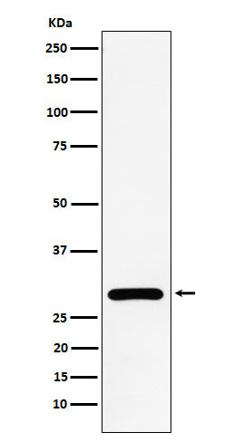 Anti-NEK6 Rabbit Monoclonal Antibody Boster Bio