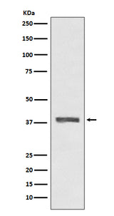 Anti-AMPK beta 1 PRKAB1 Rabbit Monoclonal Antibody Boster Bio