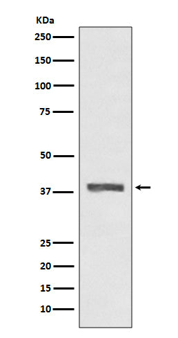 Anti-AMPK beta 1 PRKAB1 Rabbit Monoclonal Antibody Boster Bio