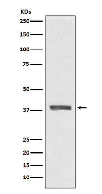 Anti-AMPK beta 1 PRKAB1 Rabbit Monoclonal Antibody Boster Bio