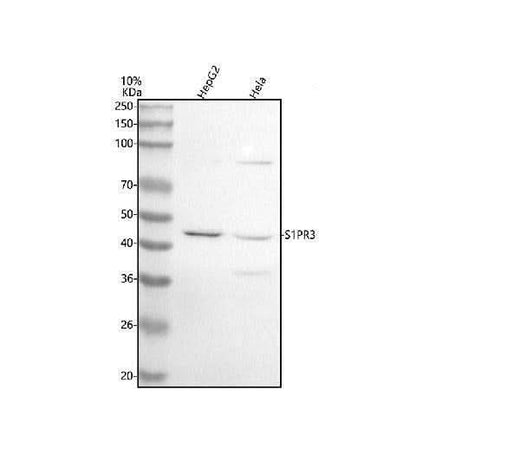 Anti-EDG3 Rabbit Monoclonal Antibody Boster Bio