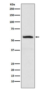 Anti-alpha Internexin INA Monoclonal Antibody Boster Bio