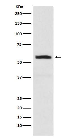 Anti-alpha Internexin INA Monoclonal Antibody Boster Bio