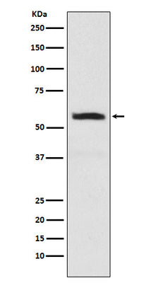 Anti-alpha Internexin INA Monoclonal Antibody Boster Bio