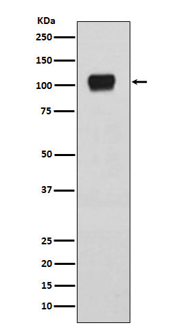 Anti-ATG9A Rabbit Monoclonal Antibody Boster Bio