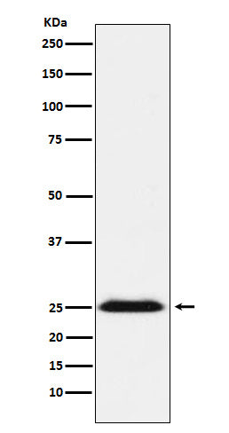 Anti-BAP31 Rabbit Monoclonal Antibody Boster Bio