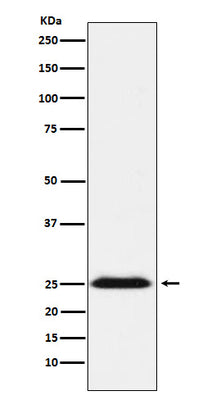 Anti-BAP31 Rabbit Monoclonal Antibody Boster Bio