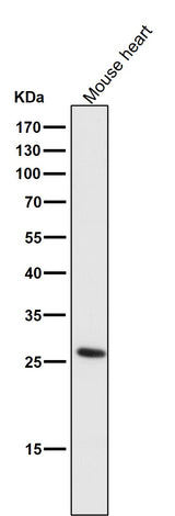 Anti-CD20 MS4A1 Rabbit Monoclonal Antibody Boster Bio