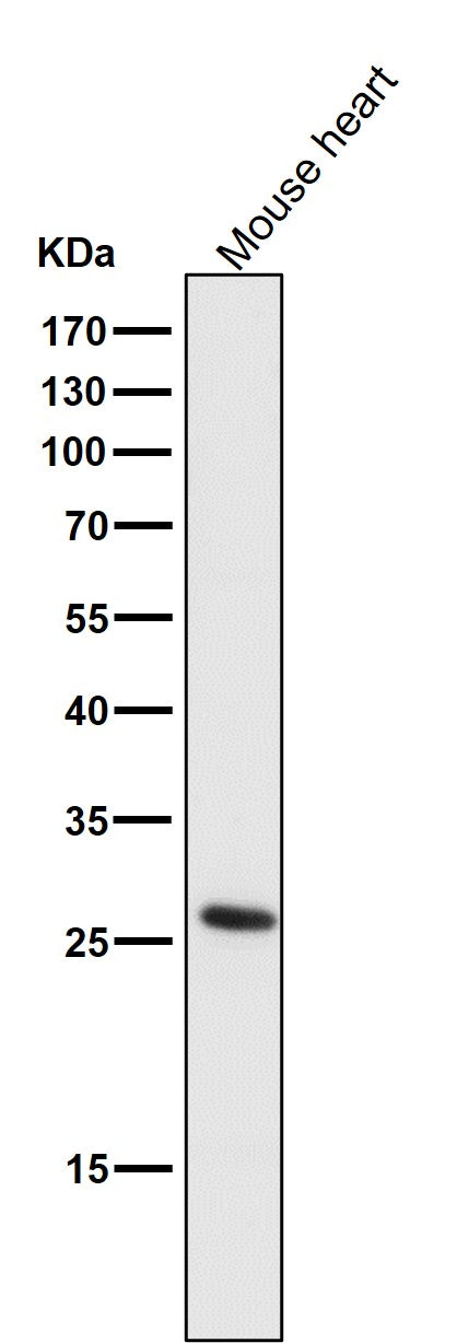 Anti-CD20 MS4A1 Rabbit Monoclonal Antibody Boster Bio