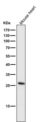 Anti-CD20 MS4A1 Rabbit Monoclonal Antibody Boster Bio