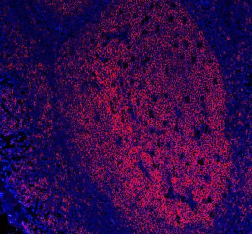 Anti-CD20/MS4A1 Antibody Picoband® (monoclonal, 4I11 Boster Bio