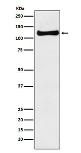 Anti-USP10 Monoclonal Antibody Boster Bio