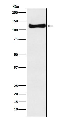 Anti-USP10 Monoclonal Antibody Boster Bio