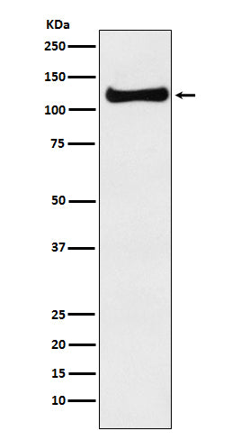 Anti-USP10 Monoclonal Antibody Boster Bio