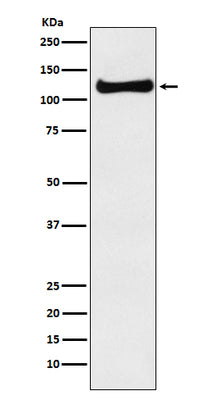 Anti-USP10 Monoclonal Antibody Boster Bio