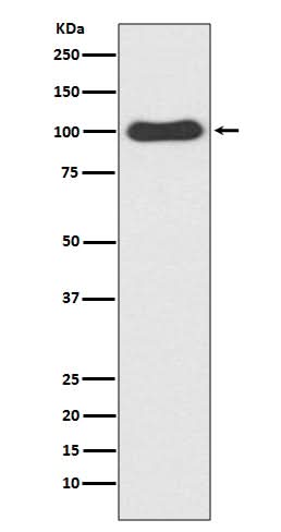 Anti-CDC5 CDC5L Rabbit Monoclonal Antibody Boster Bio