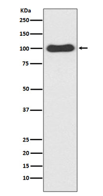 Anti-CDC5 CDC5L Rabbit Monoclonal Antibody Boster Bio
