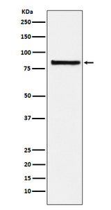 Anti-eIF2B epsilon Rabbit Monoclonal Antibody Boster Bio