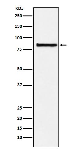 Anti-eIF2B epsilon Rabbit Monoclonal Antibody Boster Bio