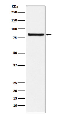 Anti-eIF2B epsilon Rabbit Monoclonal Antibody Boster Bio