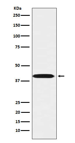 Anti-LHX3 Rabbit Monoclonal Antibody Boster Bio