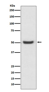 Anti-PDIA6/Erp5 Rabbit Monoclonal Antibody Boster Bio