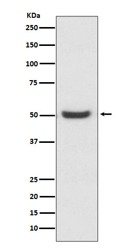Anti-PDIA6/Erp5 Rabbit Monoclonal Antibody Boster Bio
