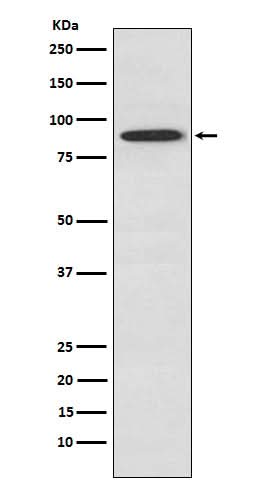 Anti-SAE2 / UBA2 Monoclonal Antibody Boster Bio
