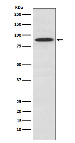 Anti-SAE2 / UBA2 Monoclonal Antibody Boster Bio