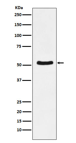 Anti-DDX6 Rabbit Monoclonal Antibody Boster Bio