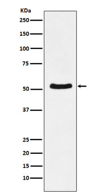 Anti-DDX6 Rabbit Monoclonal Antibody Boster Bio