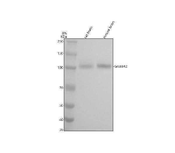 Anti-GABA B Receptor 2 Rabbit Monoclonal Antibody Boster Bio
