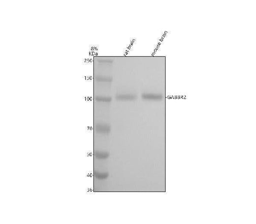 Anti-GABA B Receptor 2 Rabbit Monoclonal Antibody Boster Bio
