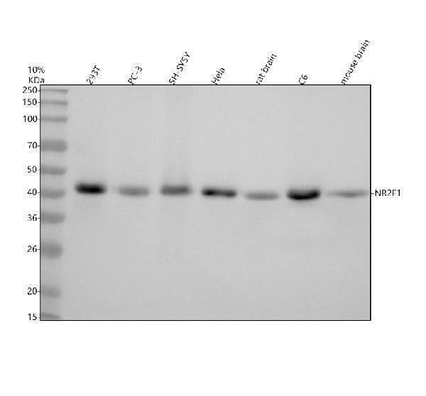 Anti-COUP TF1 NR2F1 Monoclonal Antibody Boster Bio