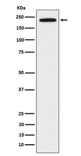 Anti-DOCK2 Rabbit Monoclonal Antibody Boster Bio