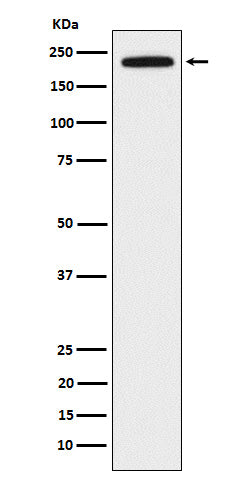 Anti-DOCK2 Rabbit Monoclonal Antibody Boster Bio