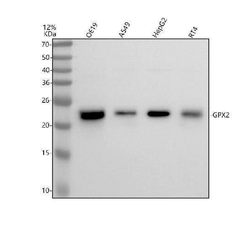 Anti-Glutathione Peroxidase 2 Rabbit Monoclonal Antibody Boster Bio