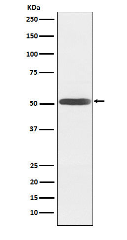 Anti-Inhibin beta B Rabbit Monoclonal Antibody Boster Bio