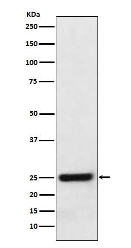 Anti-ERAB Monoclonal Antibody Boster Bio