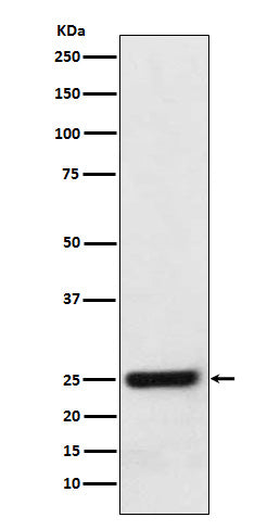 Anti-ERAB Monoclonal Antibody Boster Bio
