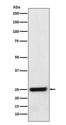 Anti-ERAB Monoclonal Antibody Boster Bio