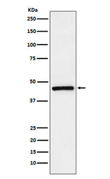 Anti-TMEFF2 Rabbit Monoclonal Antibody Boster Bio