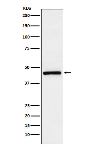 Anti-TMEFF2 Rabbit Monoclonal Antibody Boster Bio
