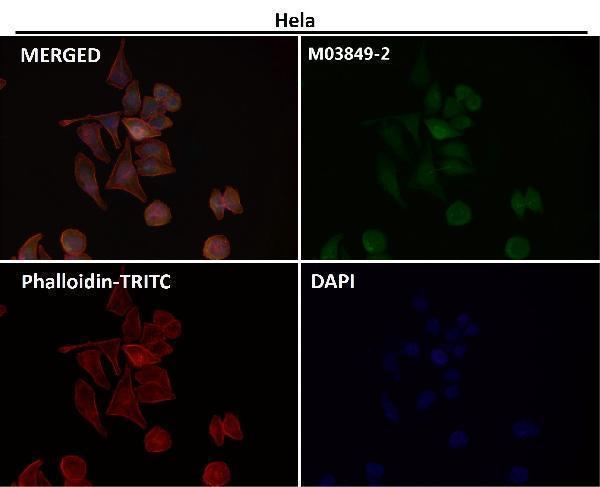 Anti-Destrin Rabbit Monoclonal Antibody Boster Bio