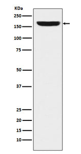 Anti-REST / NRSF Rabbit Monoclonal Antibody Boster Bio